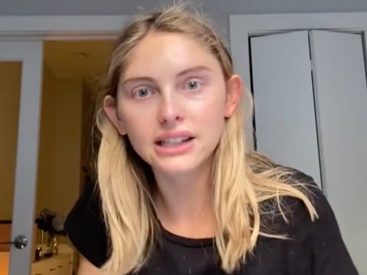 ‘Queremos ver tus huesos’: modelo talla 4 revela cómo los agentes de casting criticaron su peso