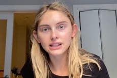 ‘Queremos ver tus huesos’: modelo talla 4 revela cómo los agentes de casting criticaron su peso