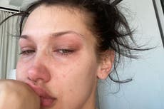 Bella Hadid publica selfies llorando para resaltar la batalla con la salud mental: “este es mi día a día”