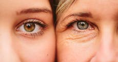 ¿Qué es el astigmatismo? La afección ocular que padece el 40 % de las personas