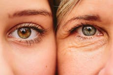 ¿Qué es el astigmatismo? El problema de la vista que afecta al 40 % de las personas