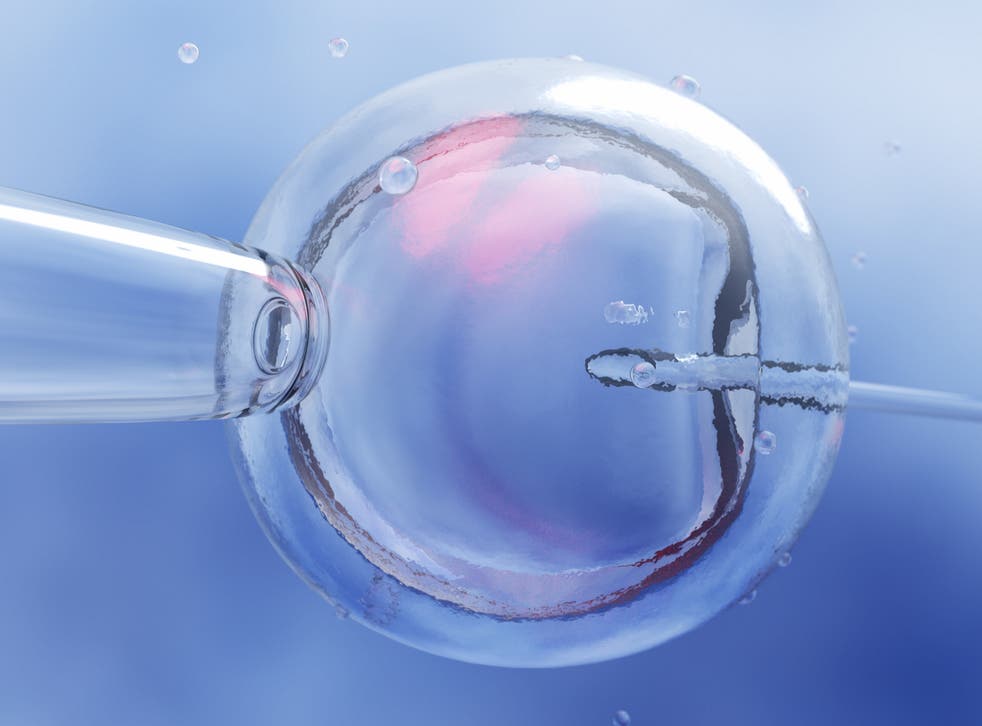 <p>Fecundación <em>in vitro </em>de un óvulo femenino a través del microscopio</p>