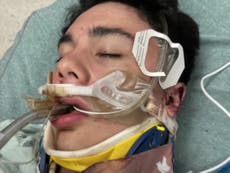 Jugador de fútbol americano adolescente golpeado hasta caer en coma en “atroz” ataque
