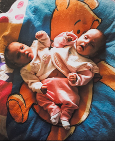 ‘La gente nos llamaba bebés monstruo’: ex gemela siamesa encuentra una nueva vida como influencer
