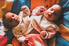 ‘La gente nos llamaba bebés monstruo’: ex gemela siamesa encuentra una nueva vida como influencer