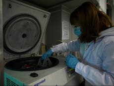 “Deltacron”: Contaminación de laboratorio es “posiblemente” responsable por híbrido delta y ómicron