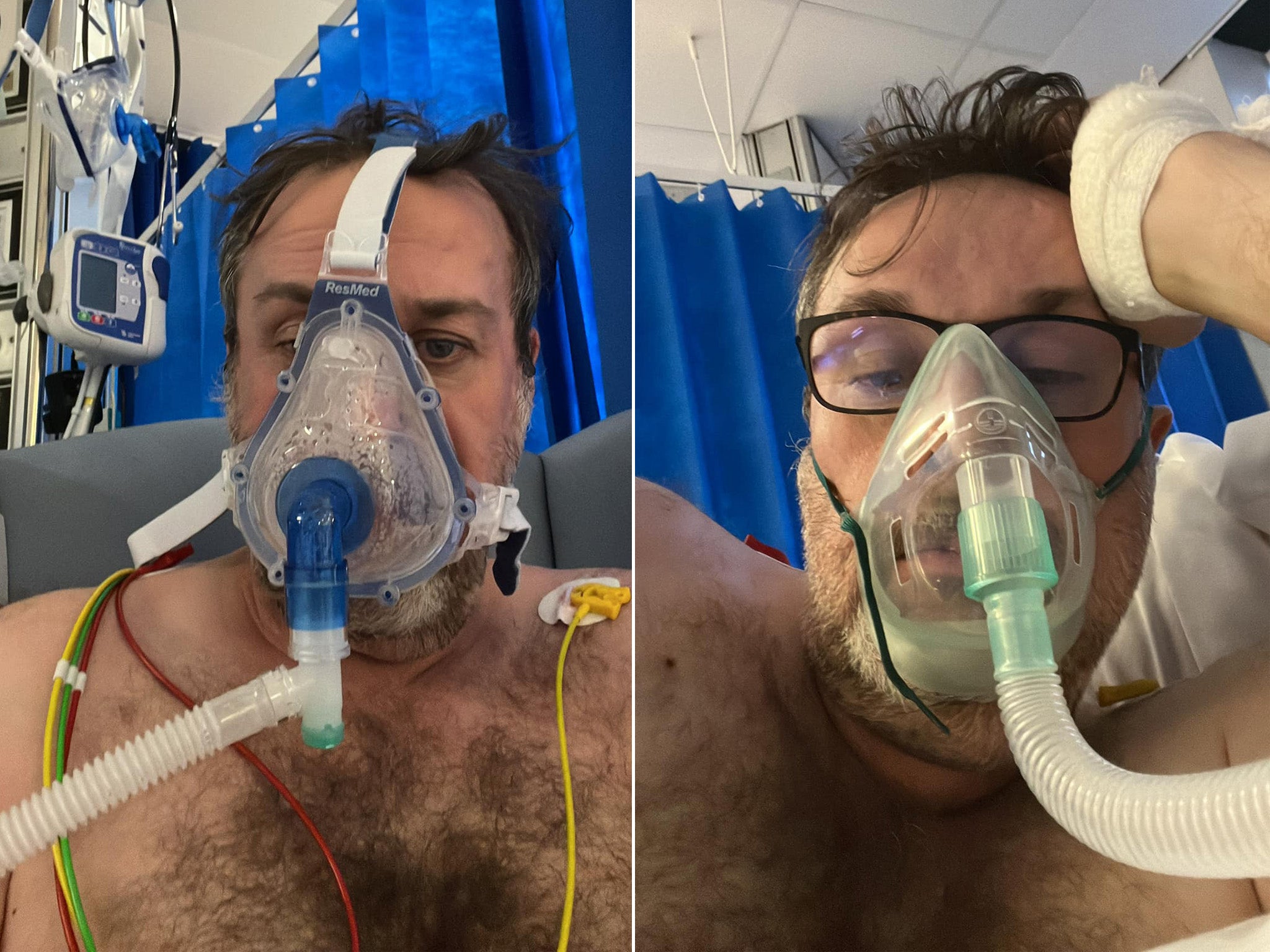 Desarrollador de videojuegos muere de covid después de no recibir vacuna por miedo a las agujas