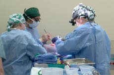 Médicos avanzan en trasplantes con órganos de cerdos