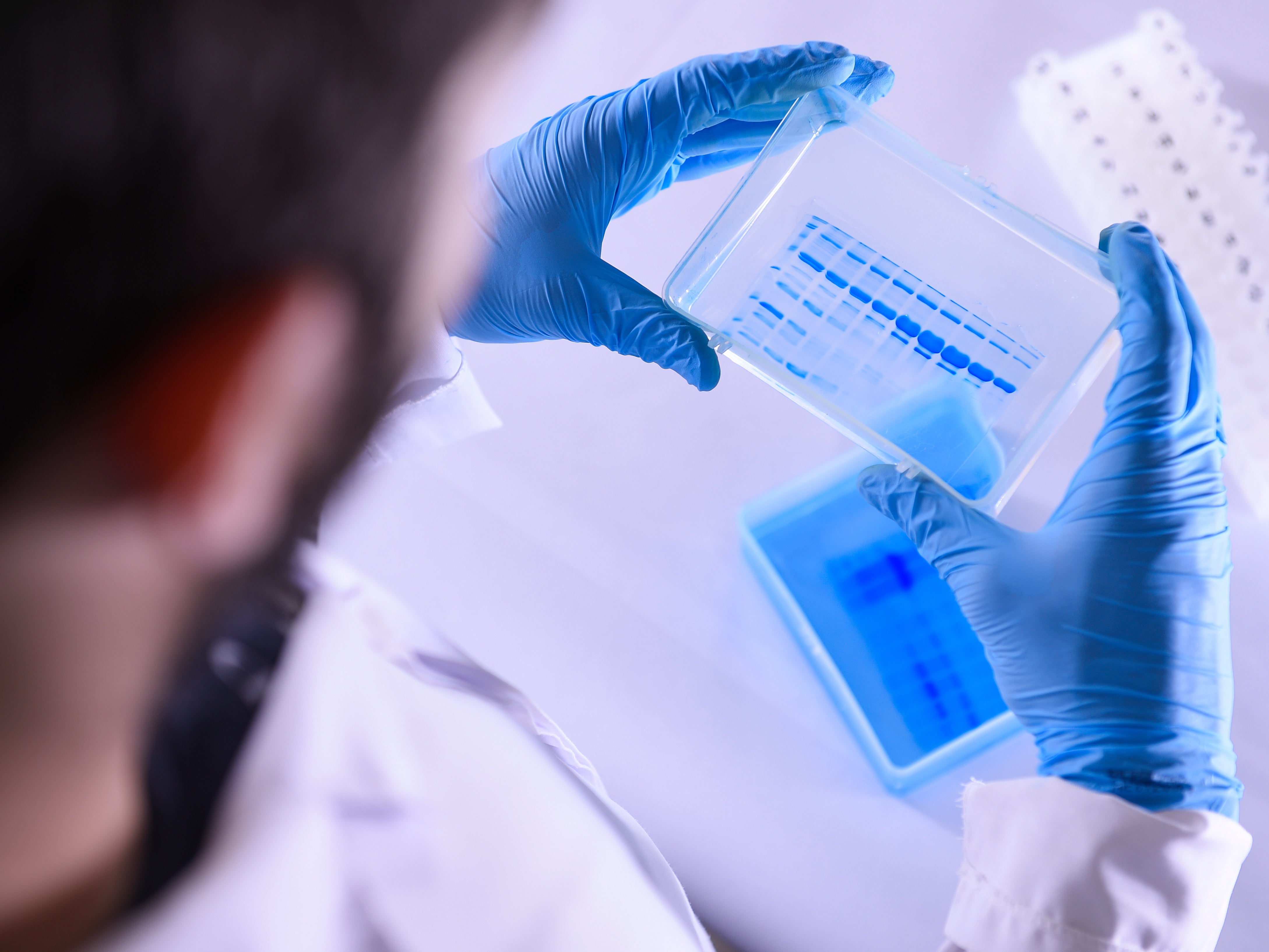 Observación del gel que evalúa la pureza de los antígenos producidos en el laboratorio el 24 de marzo de 2020 en Brasil