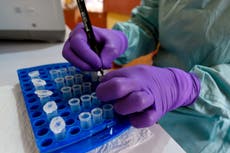 Fiebre de Lassa: Primera muerte confirmada en el Reino Unido por un nuevo brote