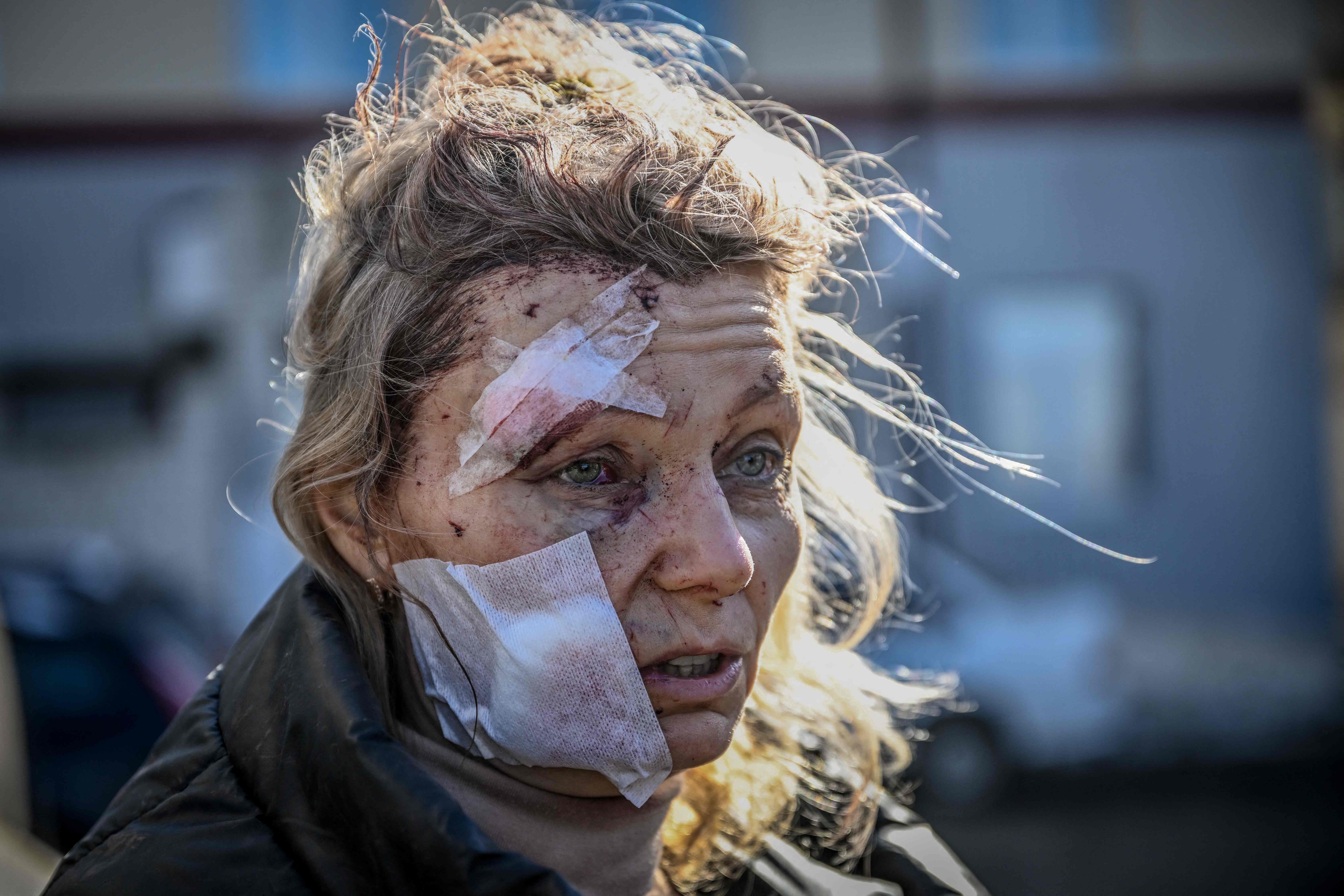 Una mujer herida afuera de un hospital en Chuguiv, Ucrania oriental, el jueves.