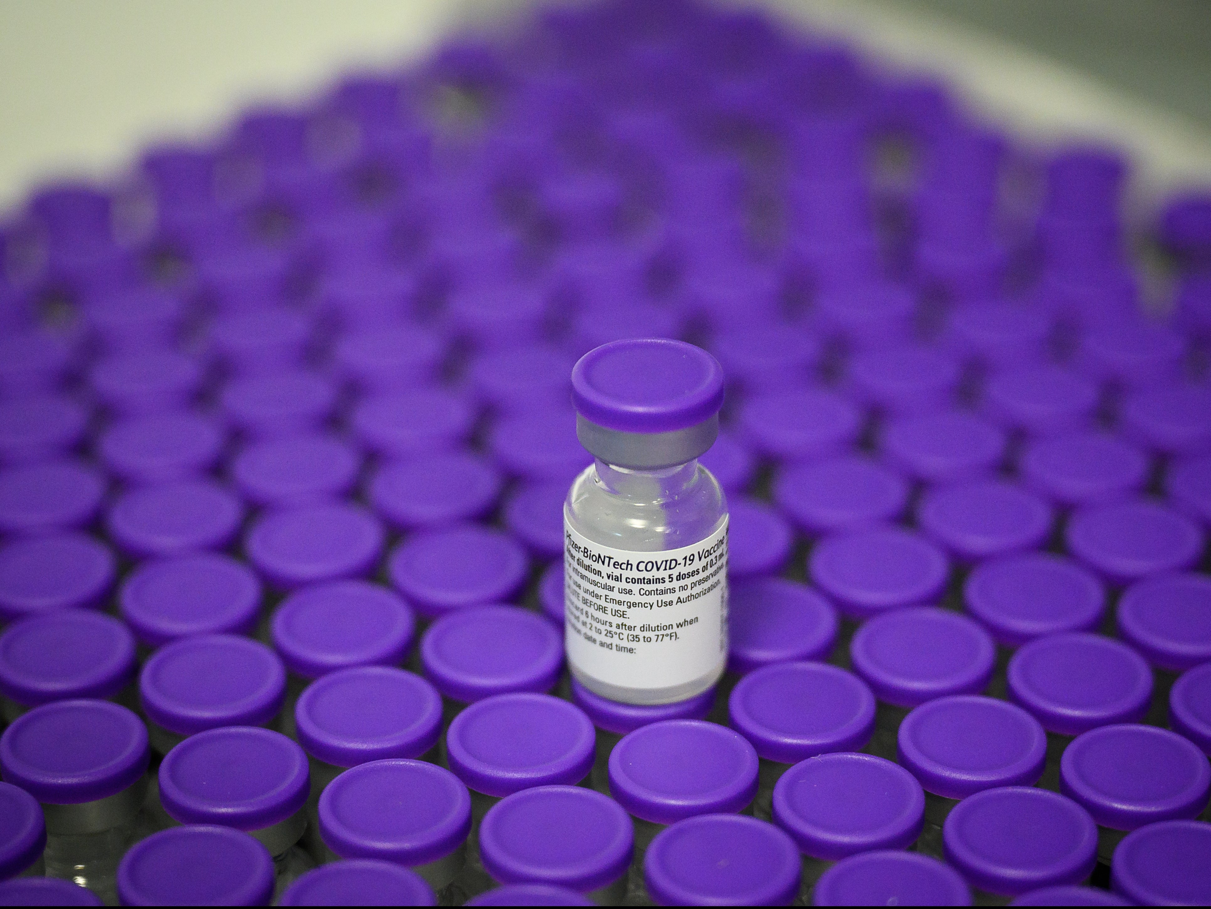 Casos leves de covid-19 también producen cambios en el cerebro, según estudio