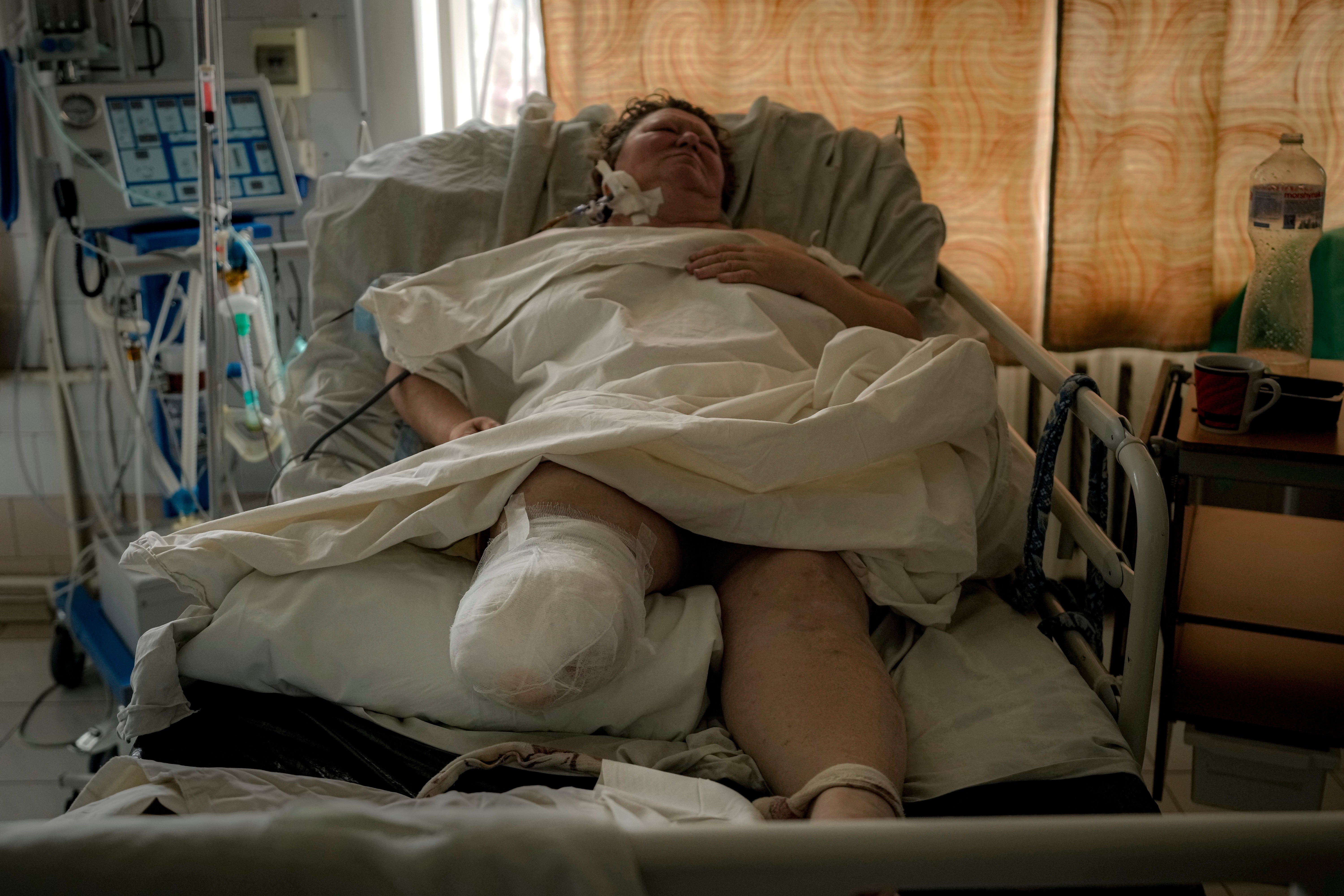 UCRANIA-GUERRA-FOTOGALERÍA