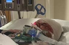 Le amputan los brazos y extirpan parte del colon a una mujer por horrible ataque de perros