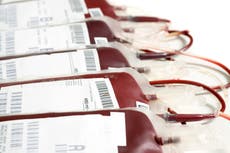 Encuentran microplásticos en sangre humana por primera vez en un estudio “extremadamente preocupante”