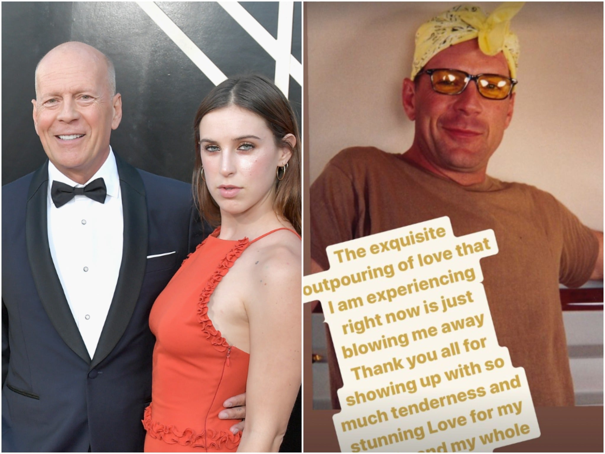 Soy una experta en afasia y esto es lo que hay que saber sobre la enfermedad de Bruce Willis 