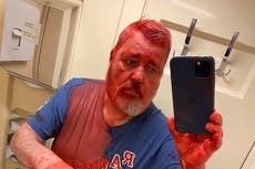 Periodista ganador del Nobel y crítico de Putin es atacado con pintura en tren