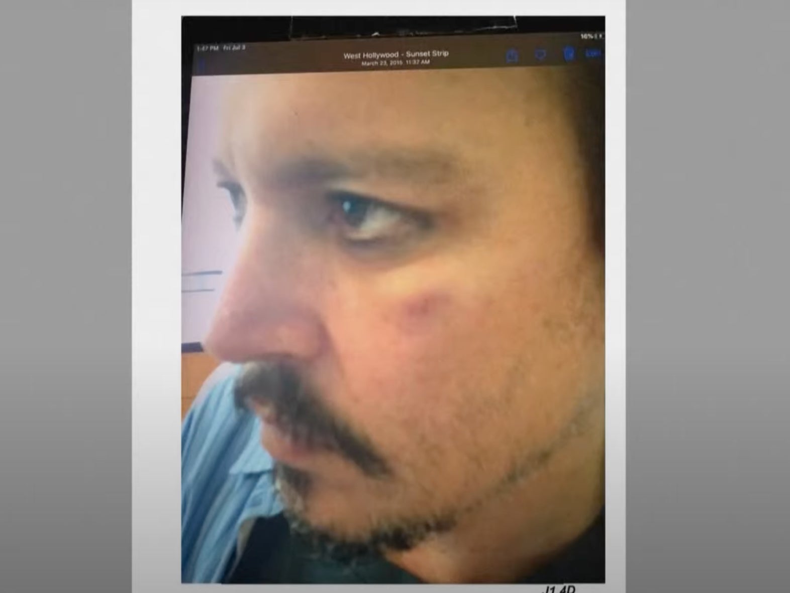 Una foto de Johnny Depp muestra al actor después de recibir lo que él describió como un “puñetazo tipo gancho” de parte de Amber Heard