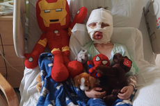 Niño de seis años sufre quemaduras de tercer grado en ataque de bullying: “Mami, me prendieron fuego”
