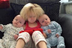 Conoce a la niña de ocho años cuya melena no se puede peinar