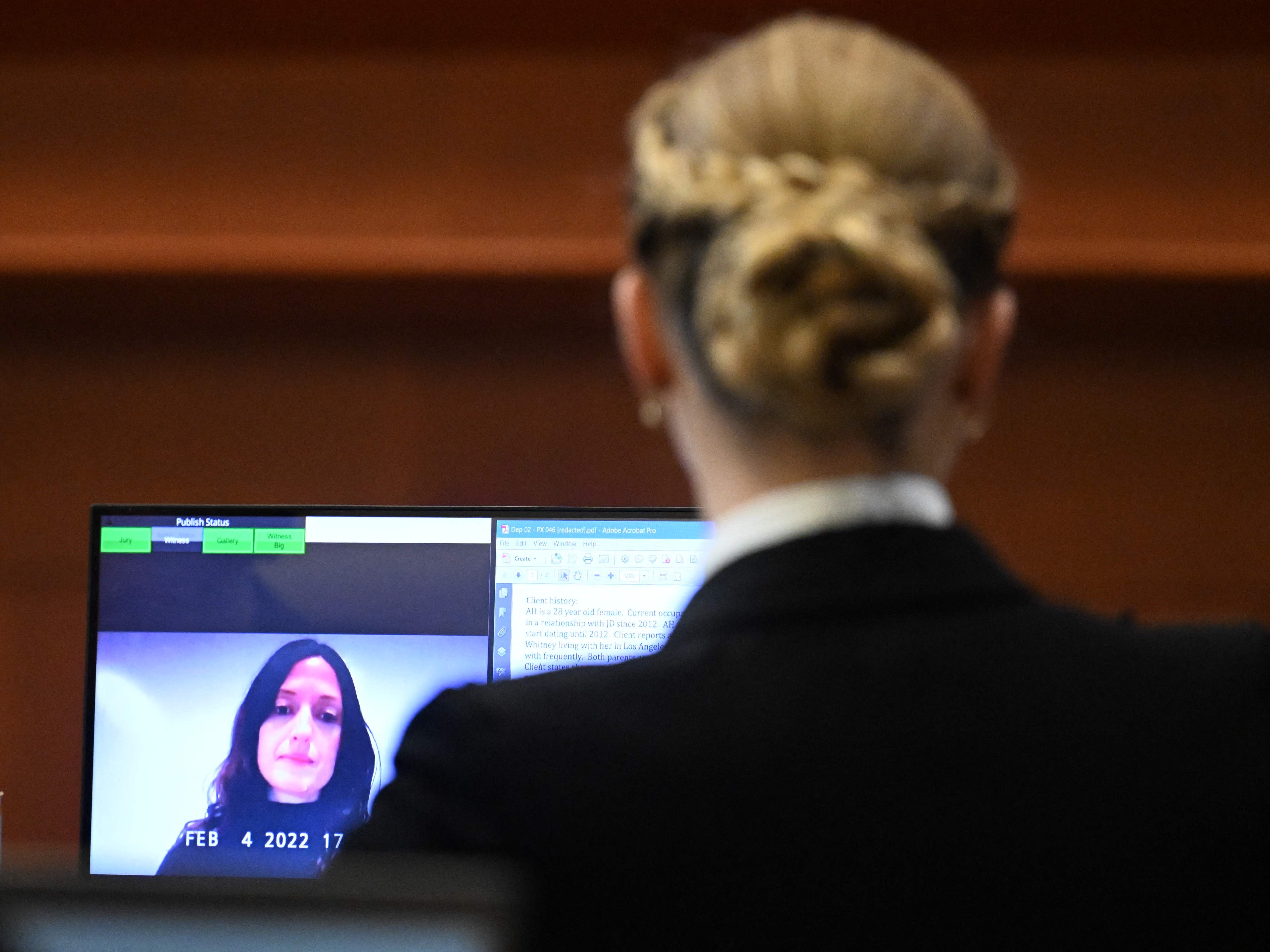 Las notas de la enfermera de Amber señalan que Heard estaba “celosa y ansiosa” de la carrera de Depp