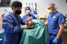 Maryland: encontraron un virus animal en el corazón de cerdo que se usó para un trasplante humano