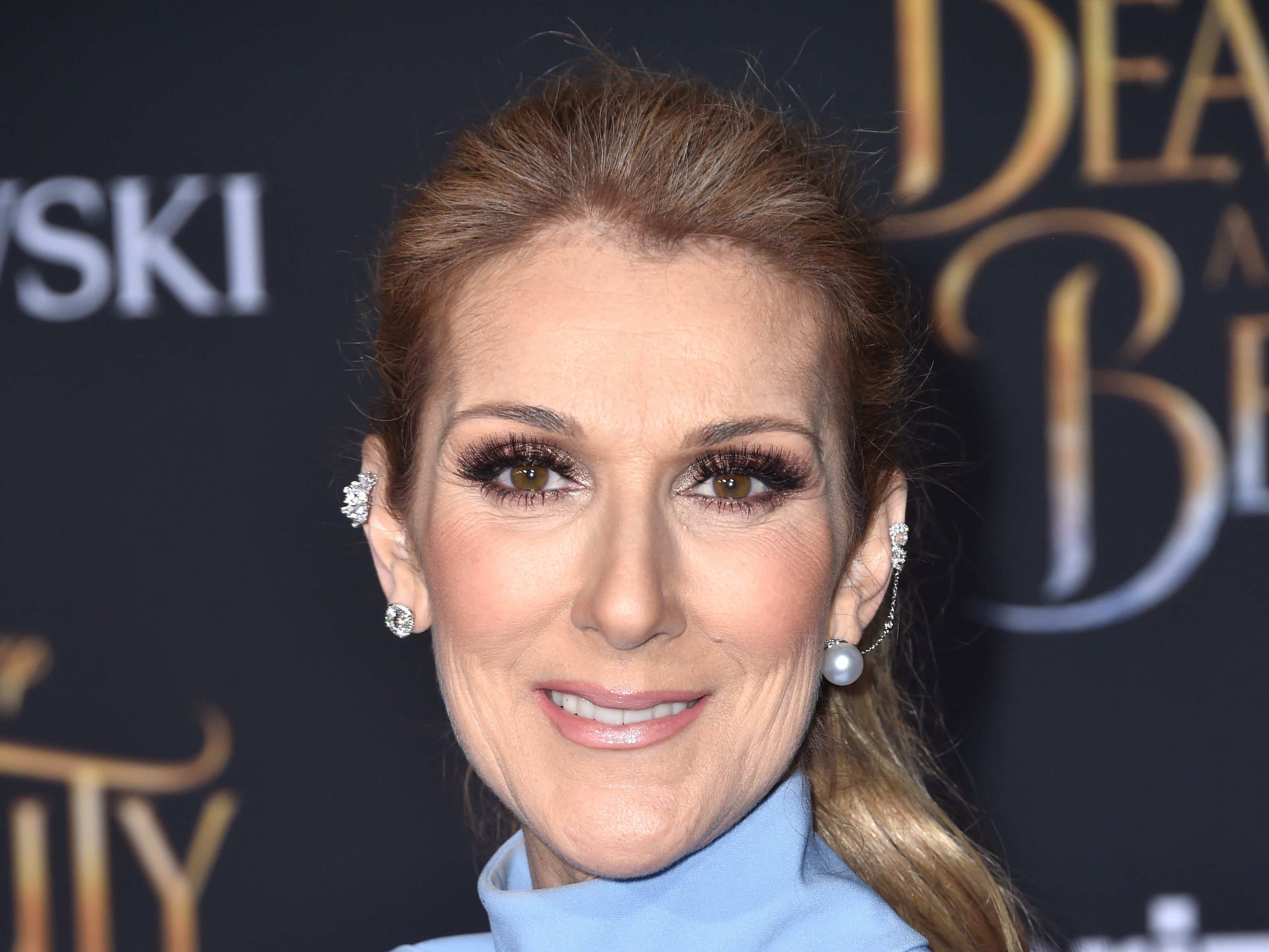 ¿Qué es el “síndrome de la persona rígida”, el trastorno incurable que padece Céline Dion?