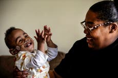 Viabilidad o el salvar a bebés nacidos prematuramente