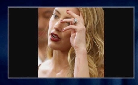 Amber Heard explica sus fotos en alfombra roja con cicatrices después de pelea con botellas de vodka con Depp