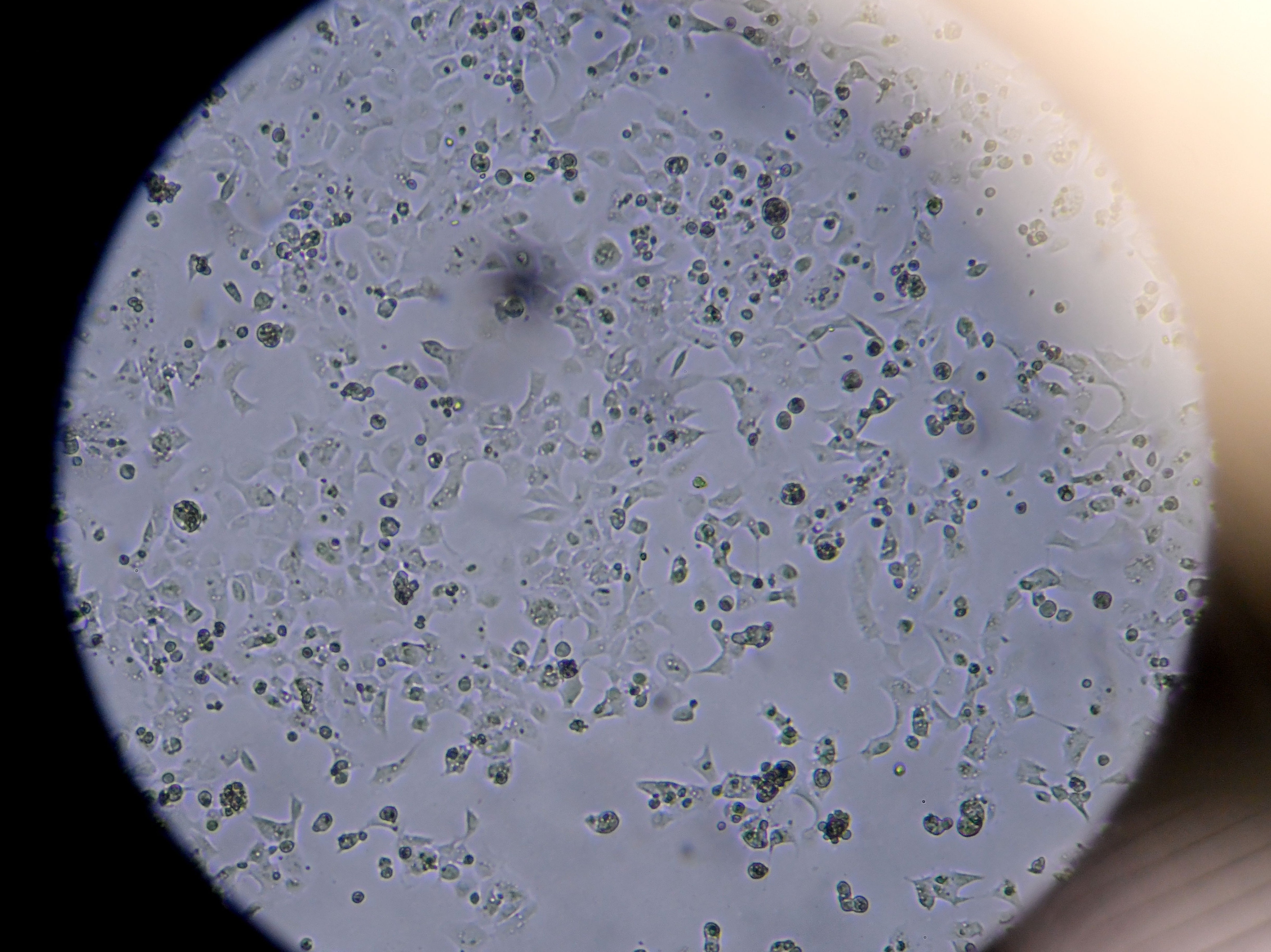 Células que contienen el nuevo coronavirus Sars-CoV-2 vistas en el microscopio
