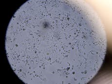 El covid-19 puede hacer que las células infectadas “exploten”, según muestra una investigación