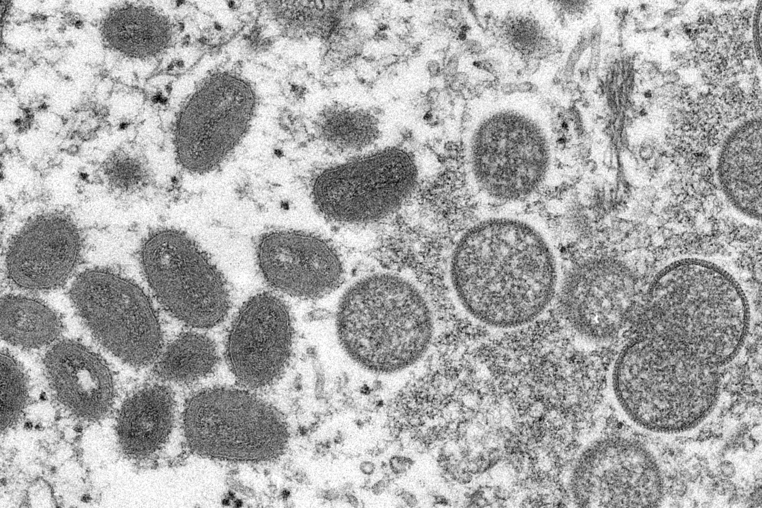 <p>Imagen de un microscopio electrónico muestra el virus de la viruela del mono</p>