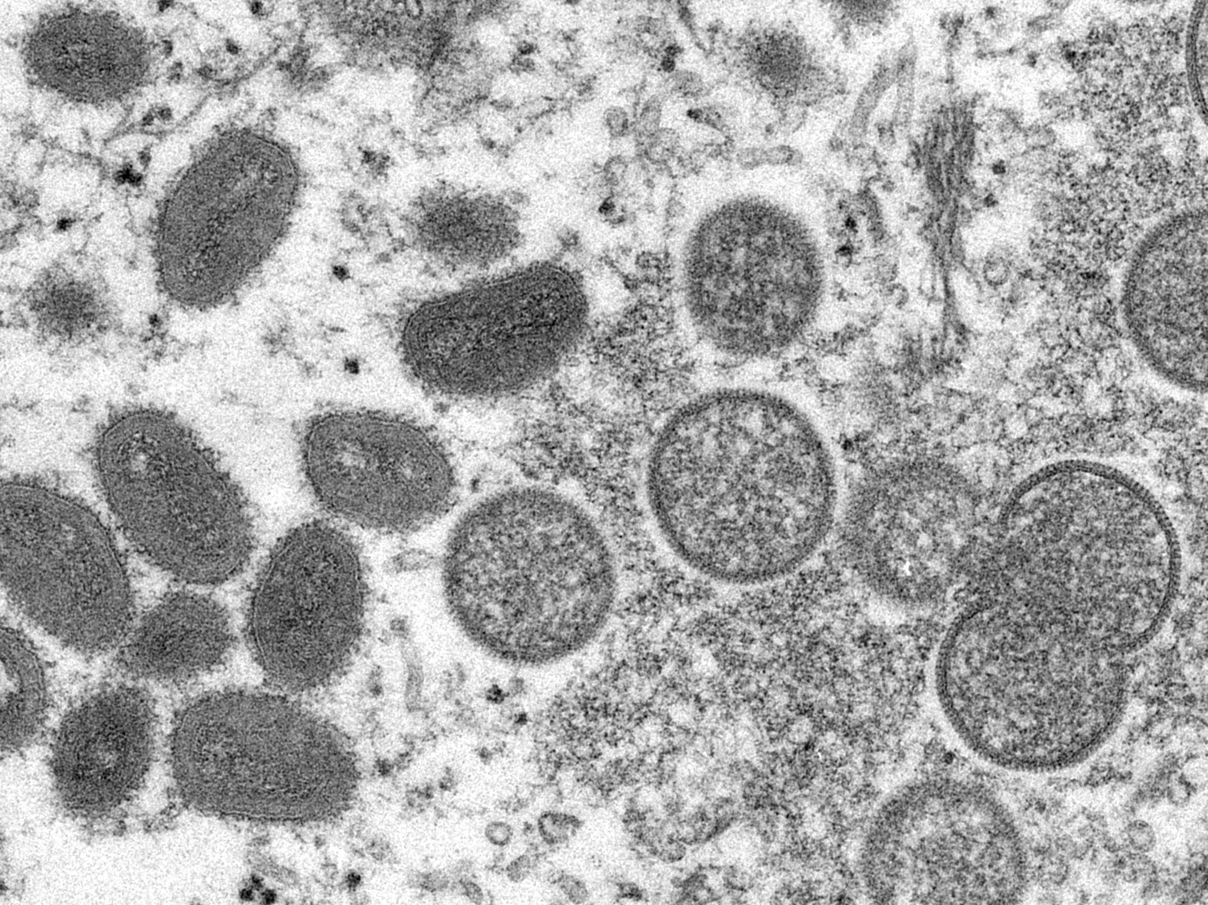 Una imagen de microscopio electrónico muestra partículas maduras y ovaladas del virus de la viruela del mono