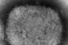 España reporta 7 casos de viruela símica en brote de Europa