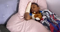 Gales: un niño negro de 11 años perdió un dedo al escapar de los “matones de la escuela”