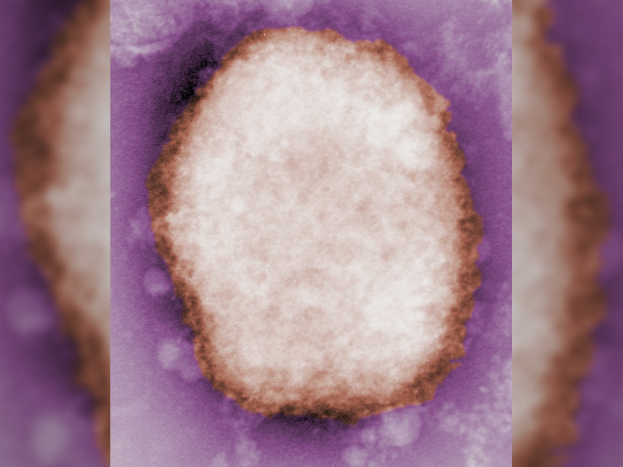 Una partícul del virus de la viruela del mono vista con un microscopio