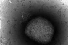 Grupos LGBTQ en España temen estigma de viruela símica