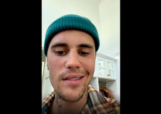 Justin Bieber experimenta “parálisis total” en el lado derecho de la cara, debido a un virus