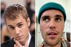 Soy un médico que investiga la parálisis facial; déjame decirte algo sobre Justin Bieber