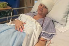 Una mujer explica los reveladores síntomas después de confundir su tumor cerebral con menopausia