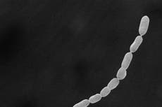 Descubren la bacteria más grande del mundo en el Caribe