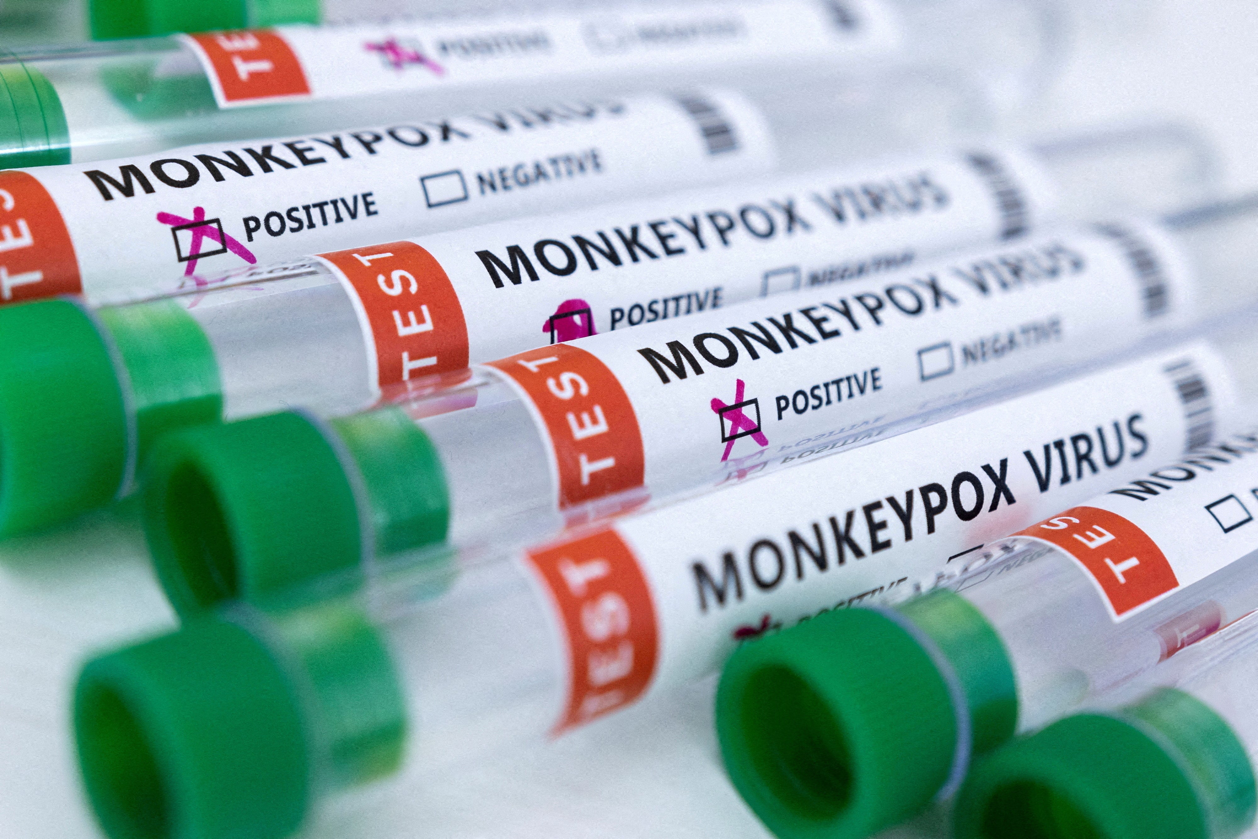Hasta el lunes, había 793 casos confirmados de viruela del mono en el Reino Unido