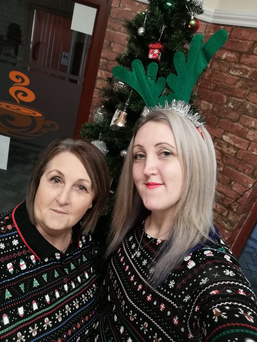 Una mujer despierta de una cirugía rutinaria con una colostomía y descubre que tiene la enfermedad de Crohn