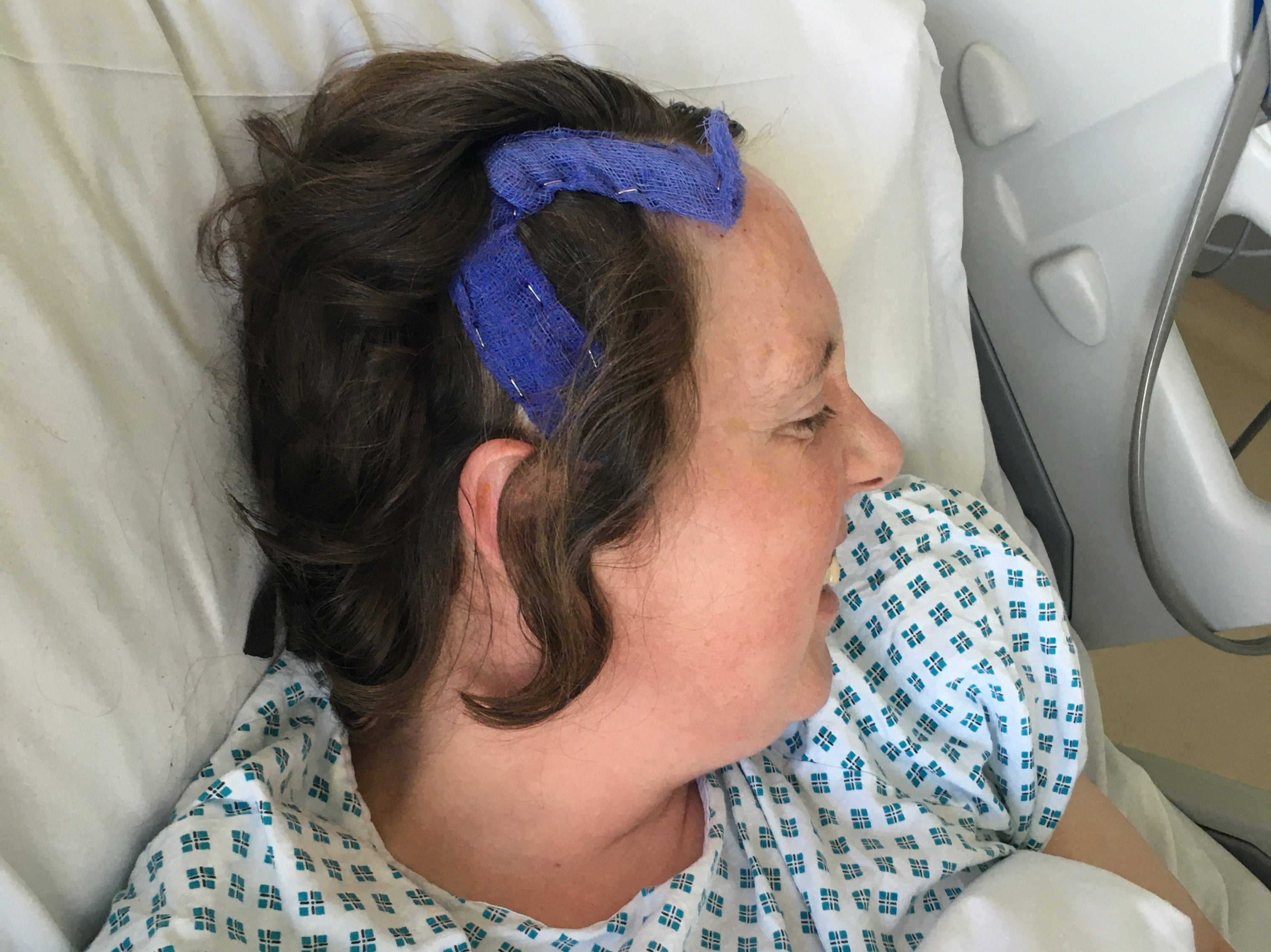 Janet Sykes fue operada y ahora está recibiendo quimioterapia regularmente para su tumor cerebral