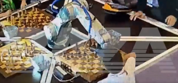 <p>El robot pellizcó la mano del niño durante la partida</p>