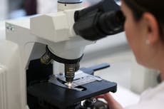 Aumentan casos de hepatitis en México hasta en 48 por ciento; la OMS quiere erradicar este mal en 2030