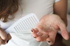 Muchas mujeres culpan a la pérdida de cabello por la falta de autoconfianza