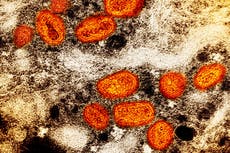 ¿La viruela del mono es una enfermedad de transmisión sexual?