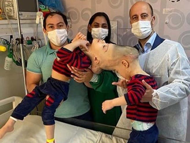 El cirujano británico Noor ul Owase Jeelani con Bernardo (izquierda) y Arthur, y los padres Adriely y Antonia Lima