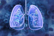 Los síntomas comunes del cáncer de pulmón que no debes ignorar